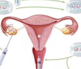 详细解读岑溪市做长方案试管婴儿费用，长方案和短方案成功率有差别吗？